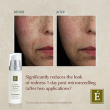 Load image into Gallery viewer, Eminence: Copper Tripeptide Serum

